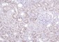 Neuropilin-1 Recombinant Rabbit mAb